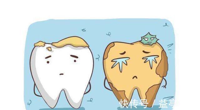 双排牙|6-12岁孩子换牙期,父母困惑可不少:双排牙、锯齿状、缝隙大等