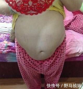 丈夫|产妇生双胞胎，孩子他爸在产房门口抱头痛哭！丈夫的话令人愤愤怒