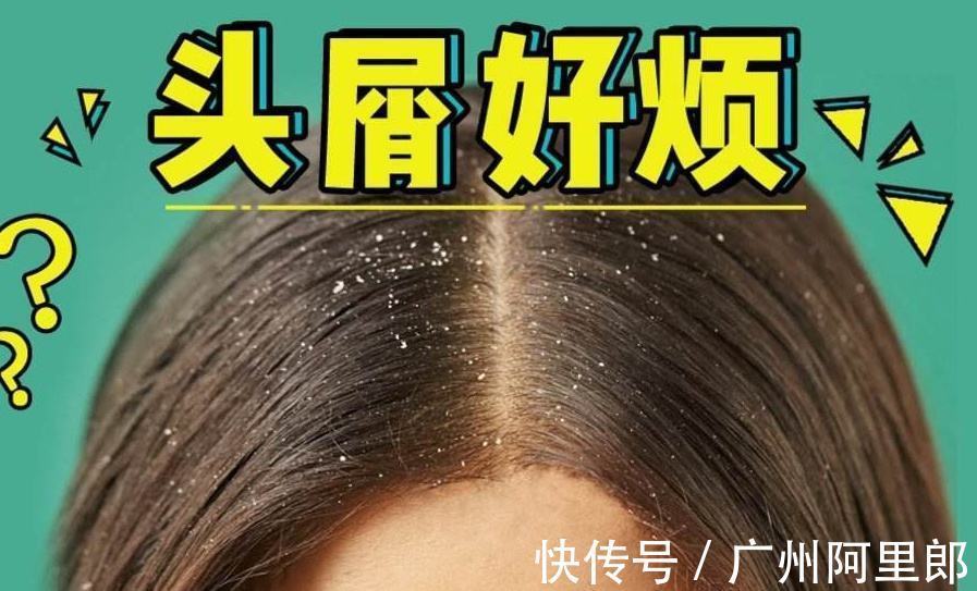 真菌|关于头屑，这篇全是干货！