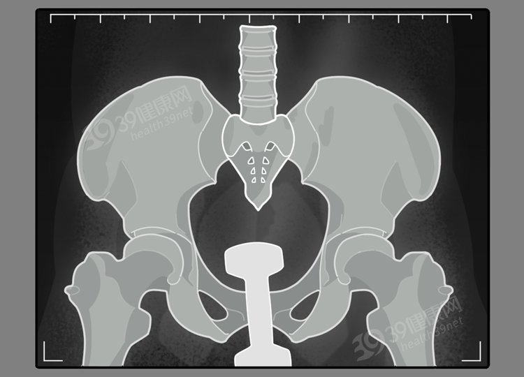 med|保护肛门有多重要？每天清洗肛门可以预防疾病？到底怎么回事？