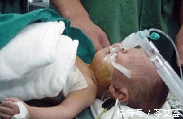 孩子|五个月男婴体重三十斤,家人带孩子常规体检,却要面临截肢的危险