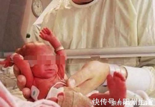 保育箱|孩子出生吓得护士都不敢抱!原因竟是因为女子流产多次!