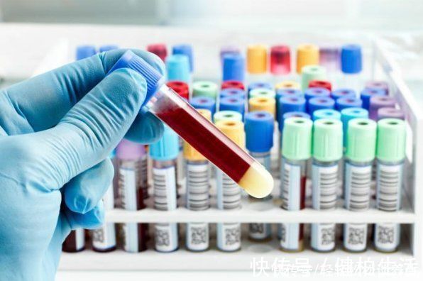 血脂|高血脂害怕2件事，不是山楂，你若能坚持做，血管垃圾一扫而空