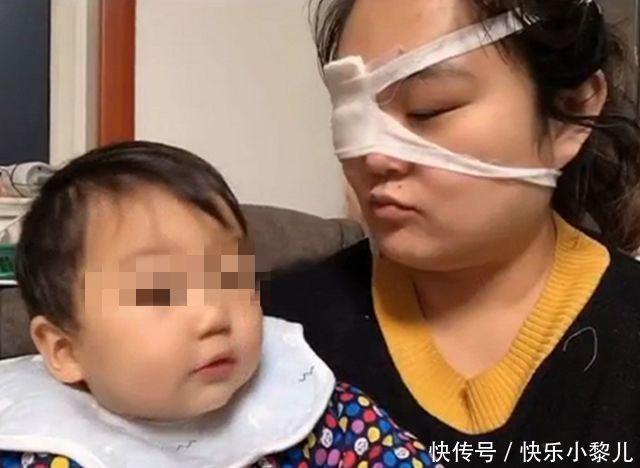 宝妈|小宝宝杀伤力有多强?宝妈:我为你剖腹7层,你却让我变“独眼”