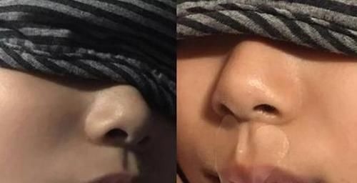 妈妈|儿子越长越像“大猩猩”,妈妈带去检查后,医生责问咋不早点来