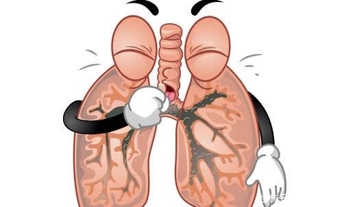 持续|身体持续出现4个症状,需警惕,或是肺癌“来袭”!