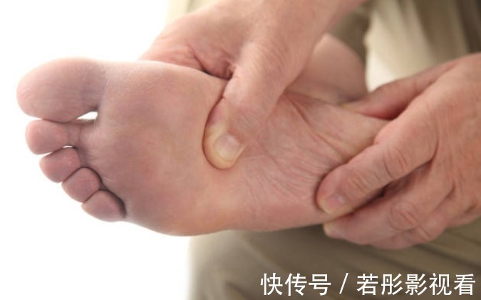 高血脂|血脂高不高，看脚就知道，若没有这4种症状，恭喜，血管还算通畅