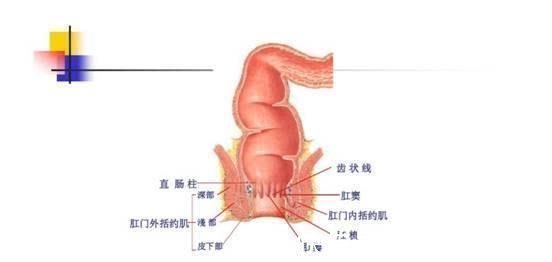 便秘|大便干燥，排便困难，慢性便秘怎么办？不妨通过文章来了解一下