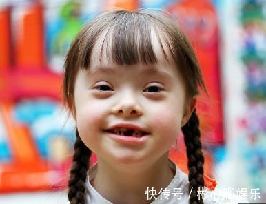 智力|每20分钟就有1位唐氏儿出生,孕妇该如何避免生出智力低的唐宝