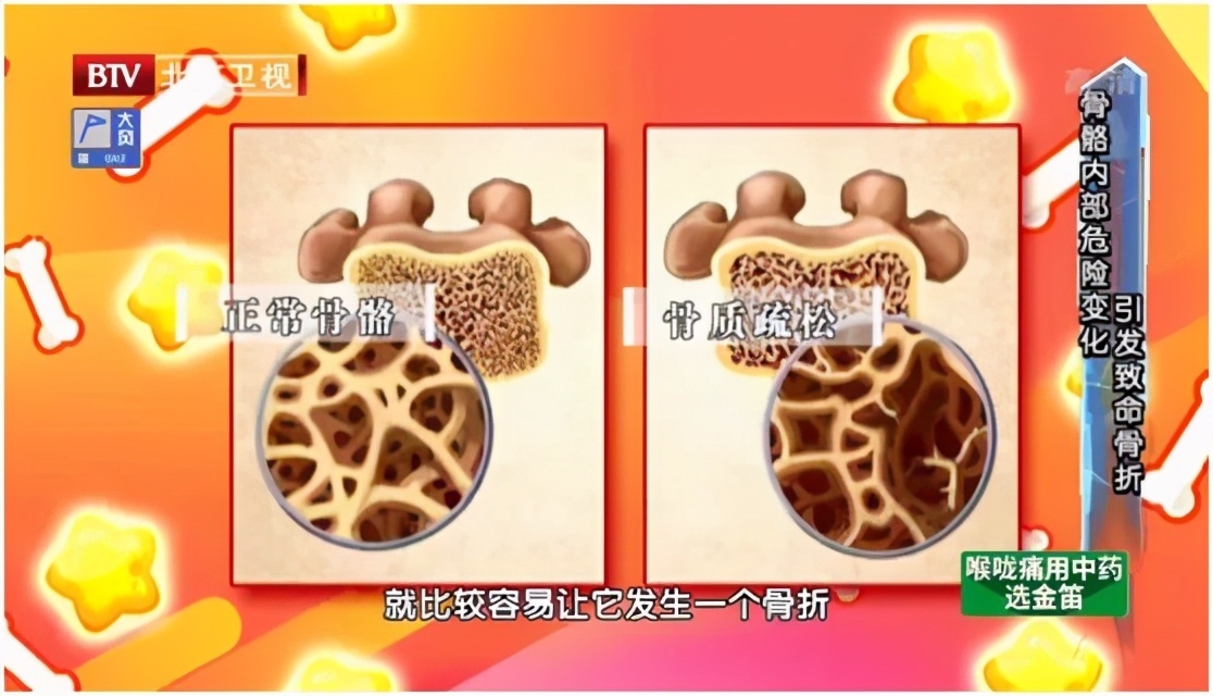 副作用|他汀的副作用不只是伤肝!还能不能吃用好它血管通畅更健康