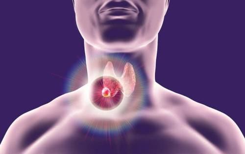 结节|甲状腺结节可以吃核桃吗？提示：想要散结，“3种零食”需少吃