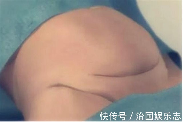 宝妈|九张剖腹产手术全过程图片,那些说生孩子容易的人好好看看