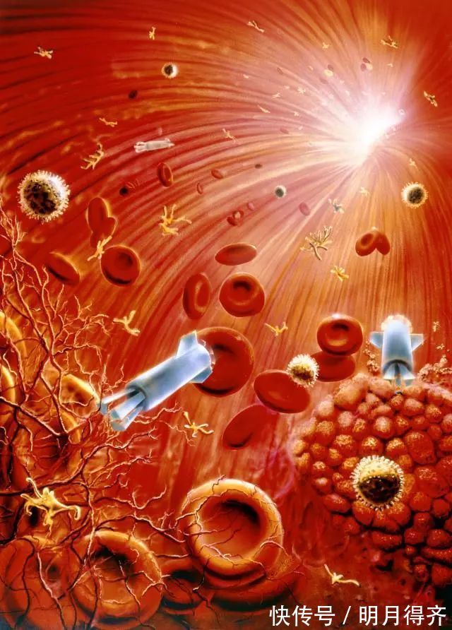 癌症|腰痛、贫血、抵抗力下降...你还不在意小心被这种癌症“盯”上