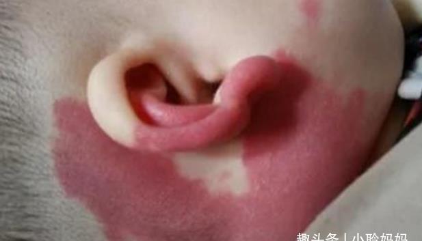 化学物质|胎儿自带“记号”,与孕妈错误行为有关,孕妈的放纵终由孩子买单