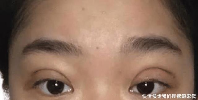 割完“双眼皮”的人,老了之后会变成什么样说出来你可能不信