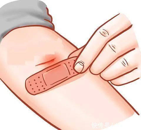 创可贴|小小的创口贴，学问可不少