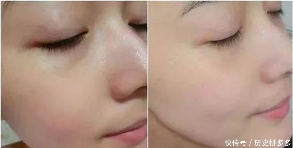 生姜果然是“祛斑高手”，坚持这样敷脸，7天见效半月恢复白皙！