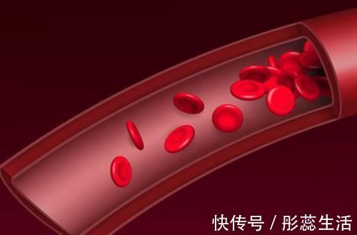 血管堵塞|老人脚上出现3种感觉，需警惕，这或暗示你血管已堵塞，莫忽视