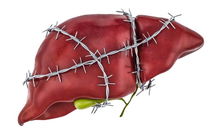 发黄|肝不好的人需警惕!早期肝病有5大症状,戒掉4大坏习惯是关键