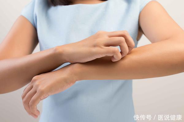 身体出现4个变化，或是肝病来报到了，需留心观察