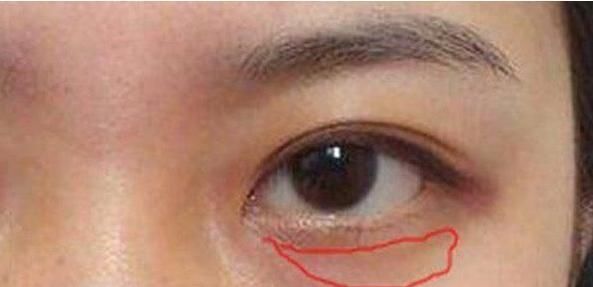 人中沟|女人患有妇科病,脸部会出现3个暗号,发现1个就最好去体检