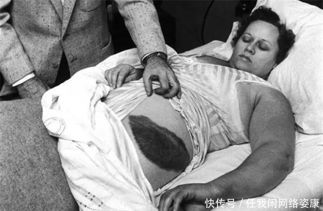 史上唯一被陨石砸中的人本可一夜暴富,却因贪婪以悲剧收场