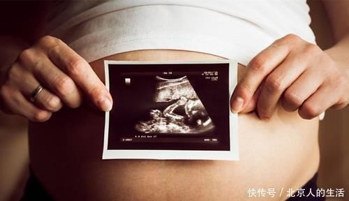 21三体综合症|孕检结果正常,却生出畸形宝宝,怀孕多少周做排畸检查准确率最高