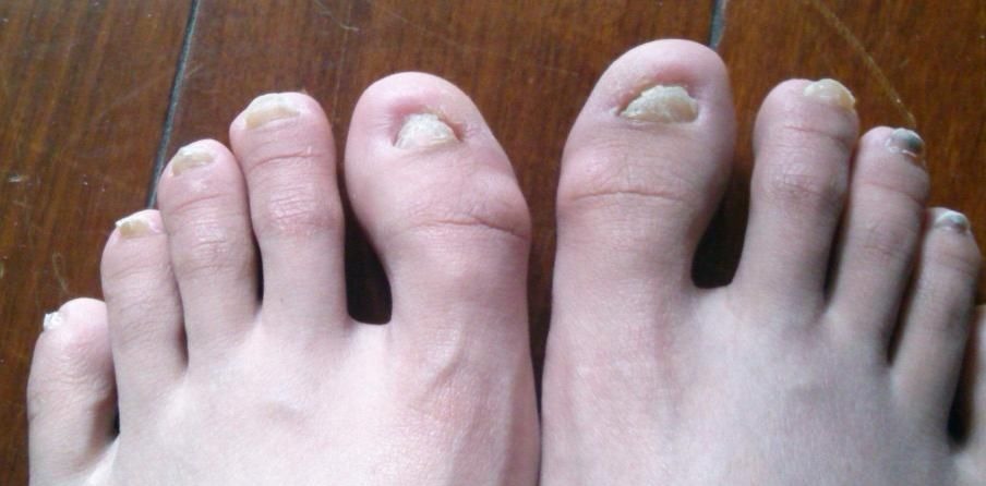 四不碰|双脚是肝脏健康的“报警器”,有4个症状,说明肝在变“坏”