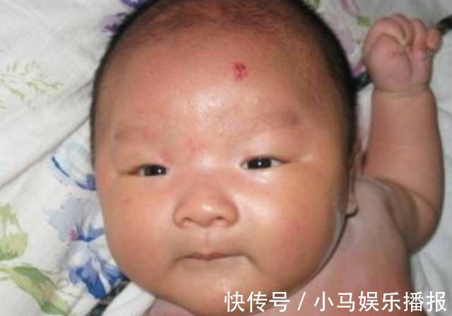 孕妇|孕妈再不改掉这些“坏习惯”,当心宝宝“胎记缠身”,别再固执了