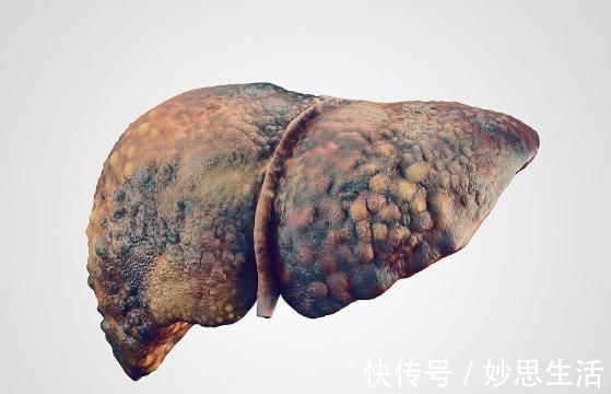 黄曲霉毒素|肝脏“良药”来了，家中常备，养护肝，保护肝细胞