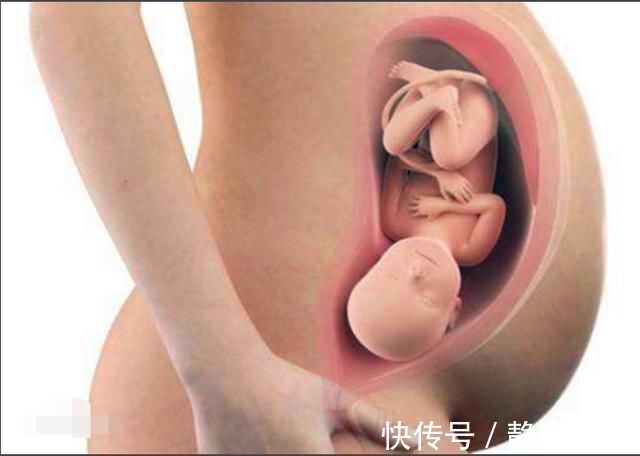 顺产|顺产“开十指”是怎么开的一组过程图让你明白什么叫为母则刚