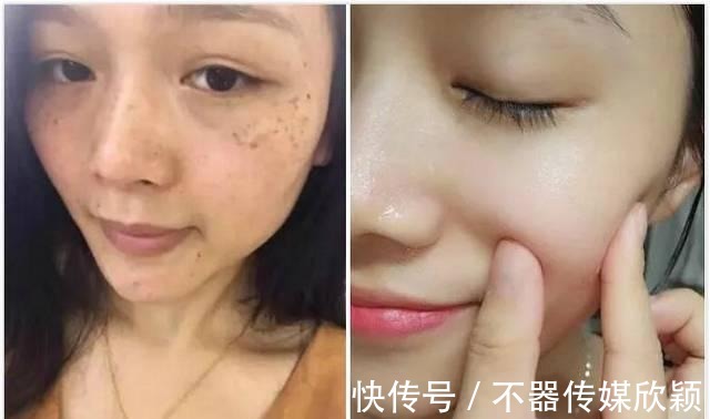 产品|祛斑产品千千万,用空瓶的只有这3款,皮肤干净得像剥了壳的鸡蛋