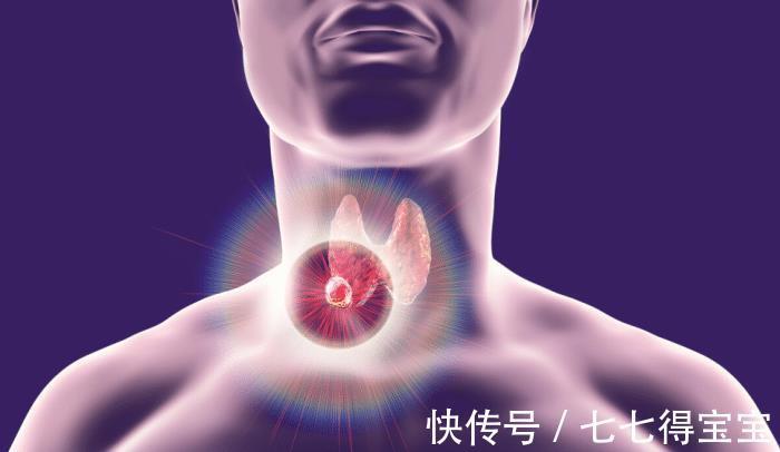 松子|甲状腺结节患者能吃豆腐吗?医生:不碰这3种食物,结节或会好转