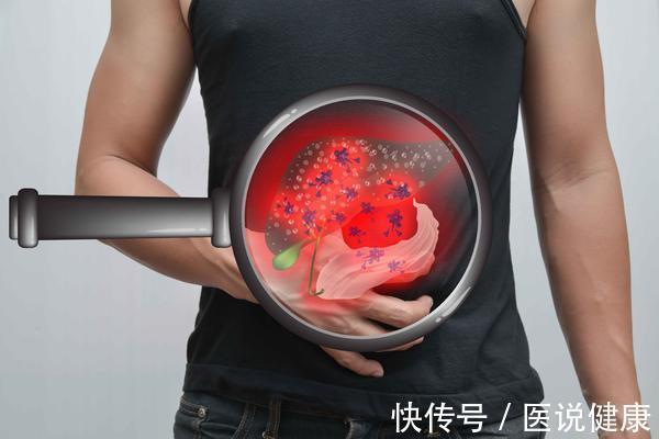 肝性脑病|得了酒精肝,不想这3个“问题”找上门,不能拖,及时检查