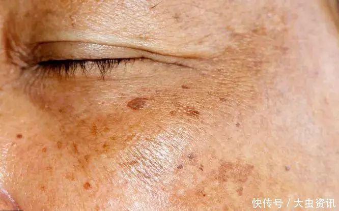 代茶饮|身体有6个表现,肝部已变“脏”,一个不占,恭喜,肝还很干净