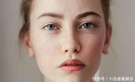 别人刷酸是蛋壳肌,你刷酸就烂脸?原因其实在这里