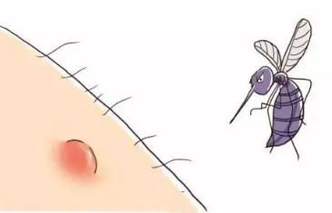 皮肤瘙痒|【提示】驱蚊止痒，风油精和清凉油具体有什么区别呢？