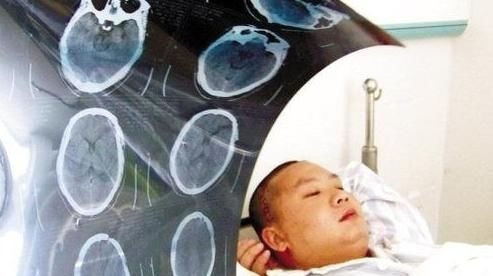 b超检查|去医院做CT检查会致癌究竟是做还是不做看看专家是怎么说