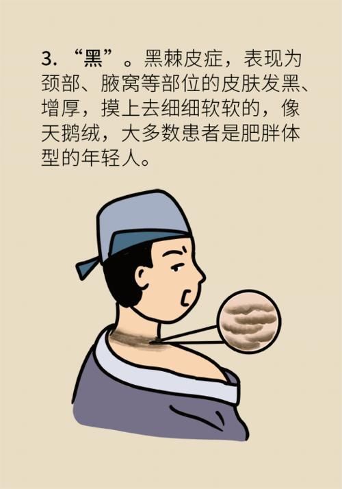 过度肥胖|血糖数值保持正常范围内等于没有糖尿病？看完下面这张图就知道了