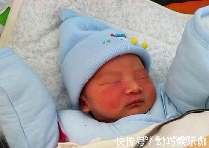 产科医生|胎记是怎么来的?妇科医生:除了遗传,孕期尽量避开这3种行为