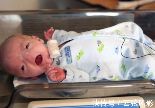鼻子|小男孩刚出生就没有鼻子,但是他的笑容感染了多少人