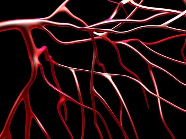 静脉|这“3物”，堪称血管清理工，每天换着吃，血管通畅更健康