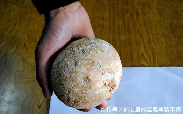 原因|膽結(jié)石和腎結(jié)石形成原因找到了這些不良飲食習(xí)慣你中招了嗎