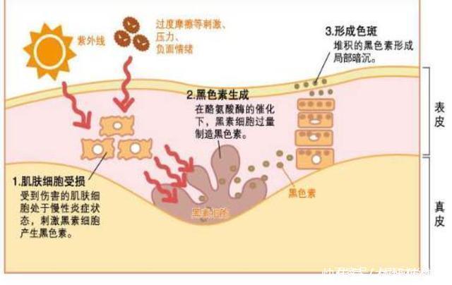 蜂蜜能淡化色斑吗效果怎么样