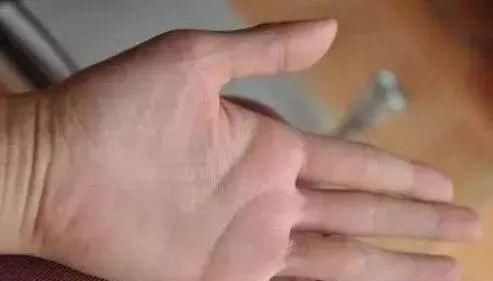 收藏|流傳幾百年的手診歌訣，面診歌訣，一看就會，果斷收藏！