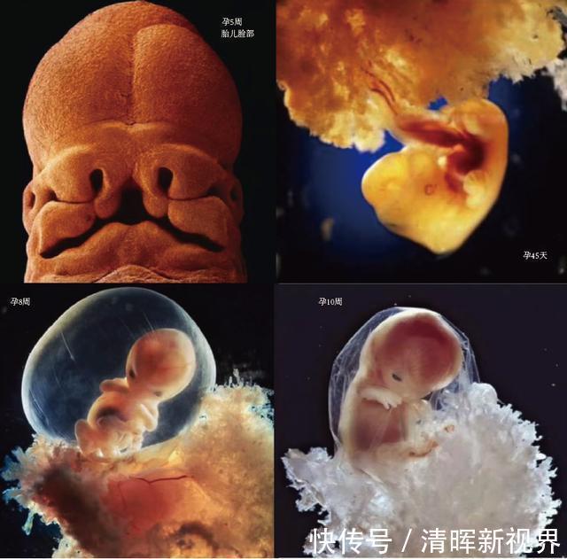 卵子|10月胎儿形成全过程，8张图带你了解真相，感受生命的奇迹