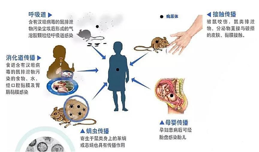 出血热|西安出现多例出血热患者——老鼠的锅，为啥让草莓来背？什么是出血热？如何预防？