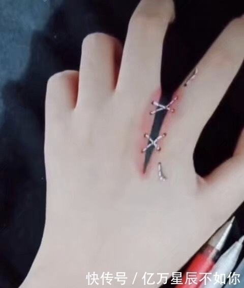 假期|学美术的都是怎么请假的老师看到伤口之后,批了一年的假期