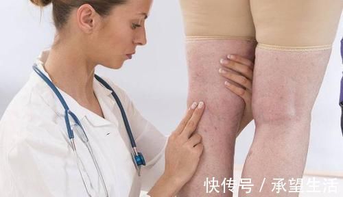 心脏|身体有4个异变,或是心脏不适导致的,要警惕心梗正在悄悄靠近