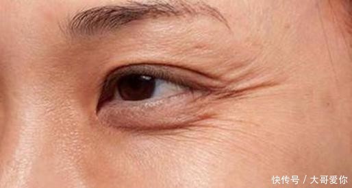  堪称|医生直言：冰箱里1种食物，堪称皮肤“灾星”，再喜欢也要扔掉